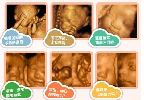 让宝宝拥有较完整的0岁相册，留下有效的记忆